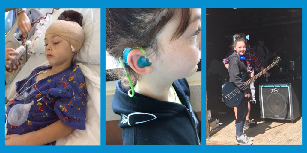 A collage of a young child who has experienced hearing loss, through Any Baby Can her family is able to afford hearing aids and she has began playing a few instruments. The first picture the child appears in a hospital bed with her ears wrapped post-surgery. The middle picture is a close-up of her hearing aid. She is seen holding a guitar in the final picture.